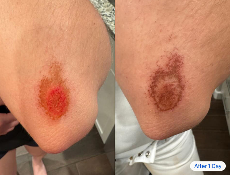 Before and after of a scrape on a person's elbow.