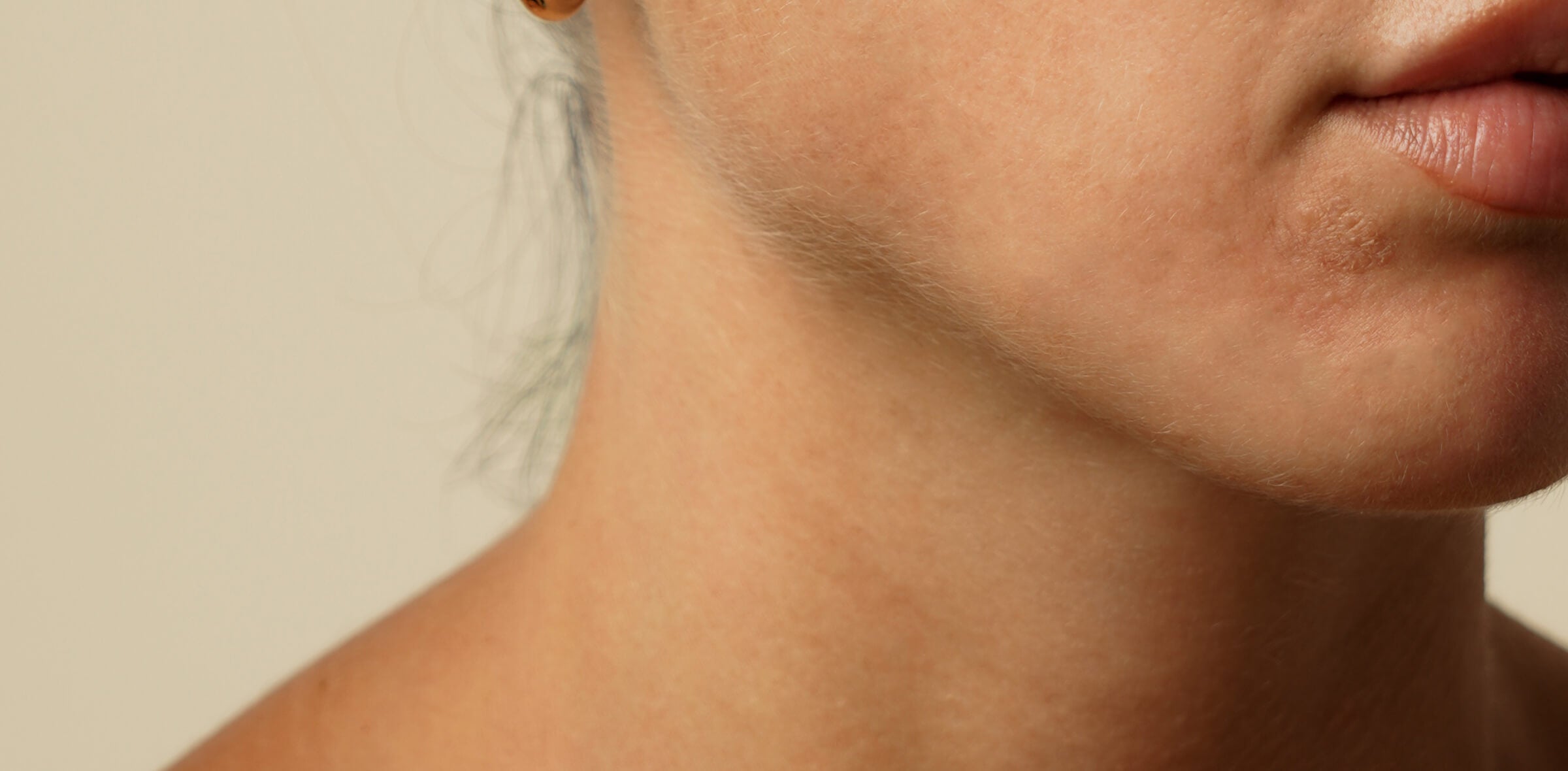 Image of a person's face with a dry skin patch near their mouth